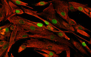 muscle cells