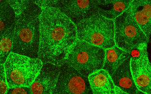 Fluconazole in rat kidney cells, AQP2 marked green