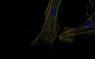 human cardiomyocytes that were derived from induced pluripotent stem cells