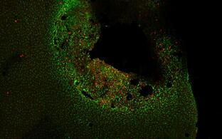 Das Bild zeigt, wie die Zellen eines Hirntumors (Gliomzellen) und Mikroglia miteinander kommunizieren.