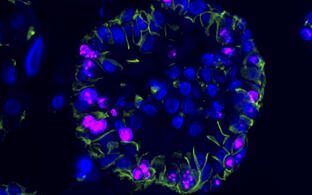 Characterization of ccRCC-derived sphere and organoid cultures