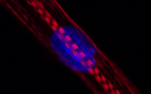 1643-MT-SkeletalMyosin.png