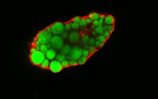 Lipidtropfen Fettzelle Adipocyte