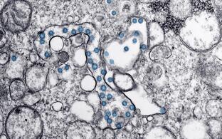 Viral Corona particles in an isolate