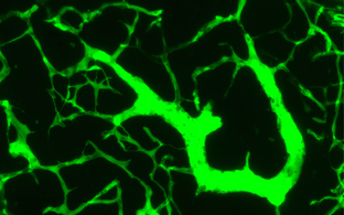 Lymph Nodes Blood Vessels