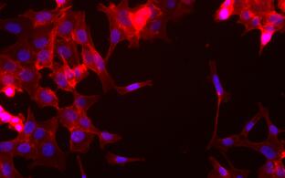 Cells leaving Primary Tumor