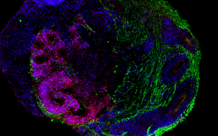 Ein Schnitt durch ein ganzes Hirnorganoid (30 Tage) zeigt die Entwicklung der Großhirnrinde: Zu sehen sind Neuronen (grün), dorsale PAX6 positive Vorläuferzellen (rot), sowie andere Zellkerne (blau).