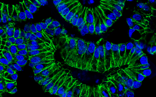 gastrointestinale Organoide