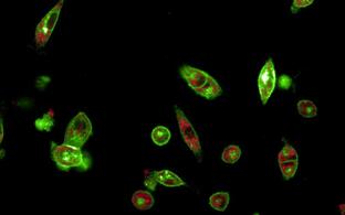 mesenchymal cells