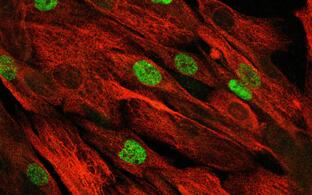 microscopic image of muscle stem cells