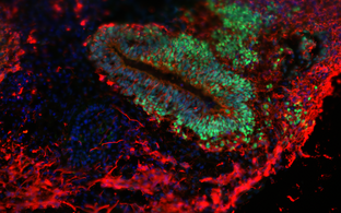 mikroskopische Aufnahme eine Organoids