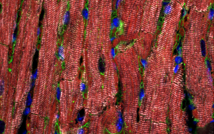 Section of the heart muscle