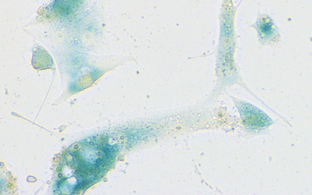 Seneszente humane ACE2-exprimierende Nasenepithelzellen nach SARS-CoV-2-Infektion