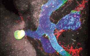 Light sheet microscopy image of the hepato-pancreato-biliary organ system and gastrointestinal tract of a mouse embryo