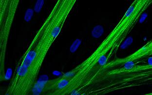 muscle stem cells fused into multinucleated myotubes