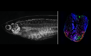 Zebrafish (left) and zebrafish heart with fibroblasts (right)