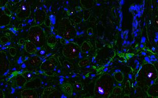 Cellular landscape of cardiac tissue