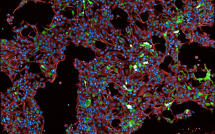 lung epithel cells