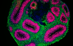 Wissenschaftliches Bild eines Hirn-Organoids