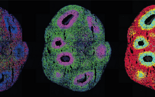 Three Cerebral organoids