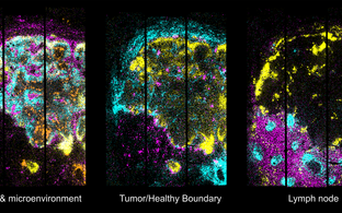 2D map of gene expression in the metastatic lymph node
