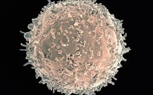 Colorized scanning electron micrograph