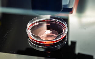 Organoids in petri dish