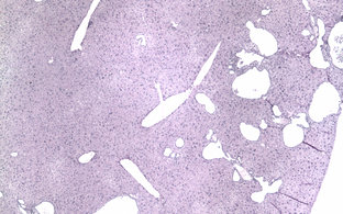 stained tissue sections of a mouse liver after base editing