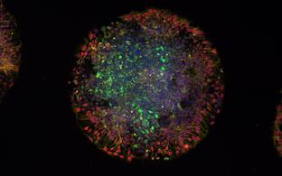 A day-old micropatterned organoid generated from induced pluripotent stem cells (iPSCs) derived from a patient with a mutation in the IRF2BPL gene. The different colors mark distinct cell populations, which reveal how the organoid is organizing into layers of developing neural tissue. It provides a snapshot of early human brain-like development in this patient-derived model.