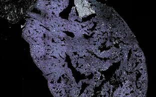 Zebrafish heart after cryoinjury