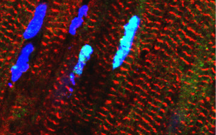 Das Bild zeigt Herzmuskelzellen, in denen das RBM20-Protein hellblau leuchtet.