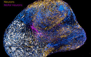 Neuromuskulares Organoid