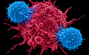 CAR T cells attacking a cancer cell