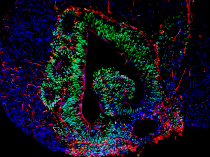 Brain organoids