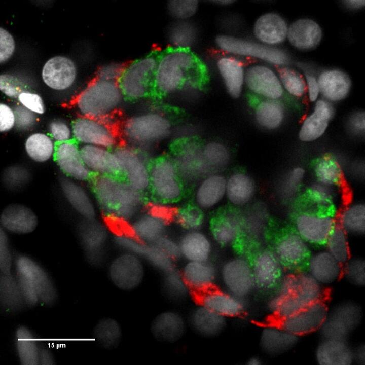 Islet cells in the pancreas of a zebrafish