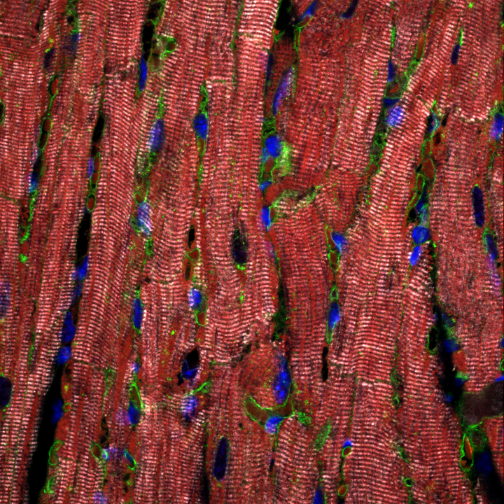 Section of the heart muscle
