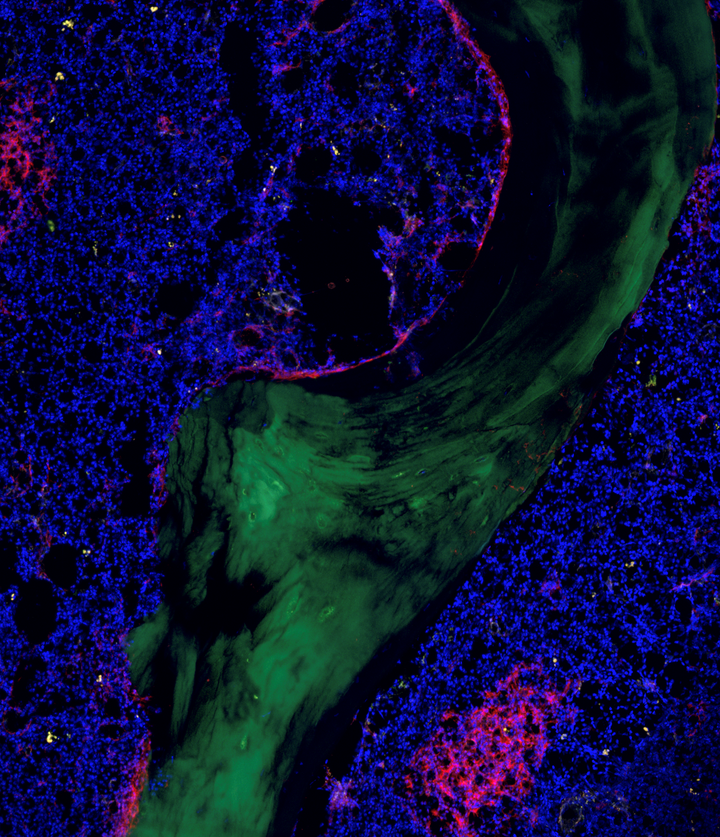 Human bone marrow