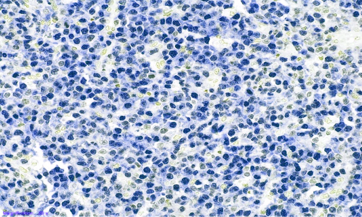 Microscopic image of IRF4