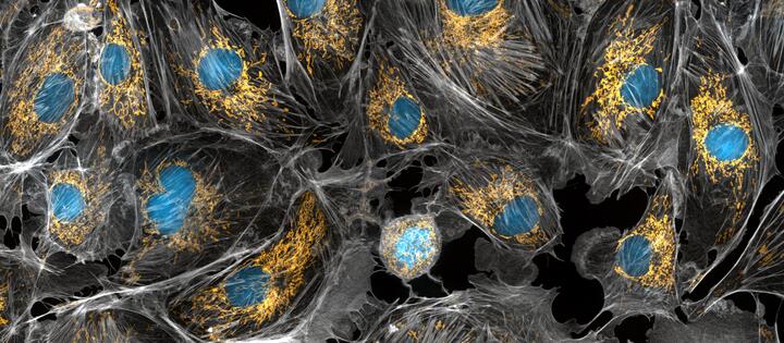 cow cells taken with a microscope. the mitochondria were stained in bright yellow to visualize them in the cell. The large blue dots are the cell nuclei and the gray web is the cytoskeleton of the cells.