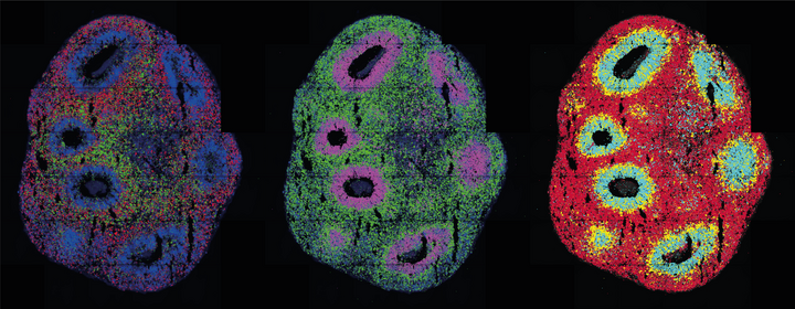 Three Cerebral organoids