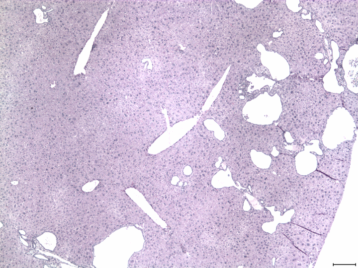 stained tissue sections of a mouse liver after base editing