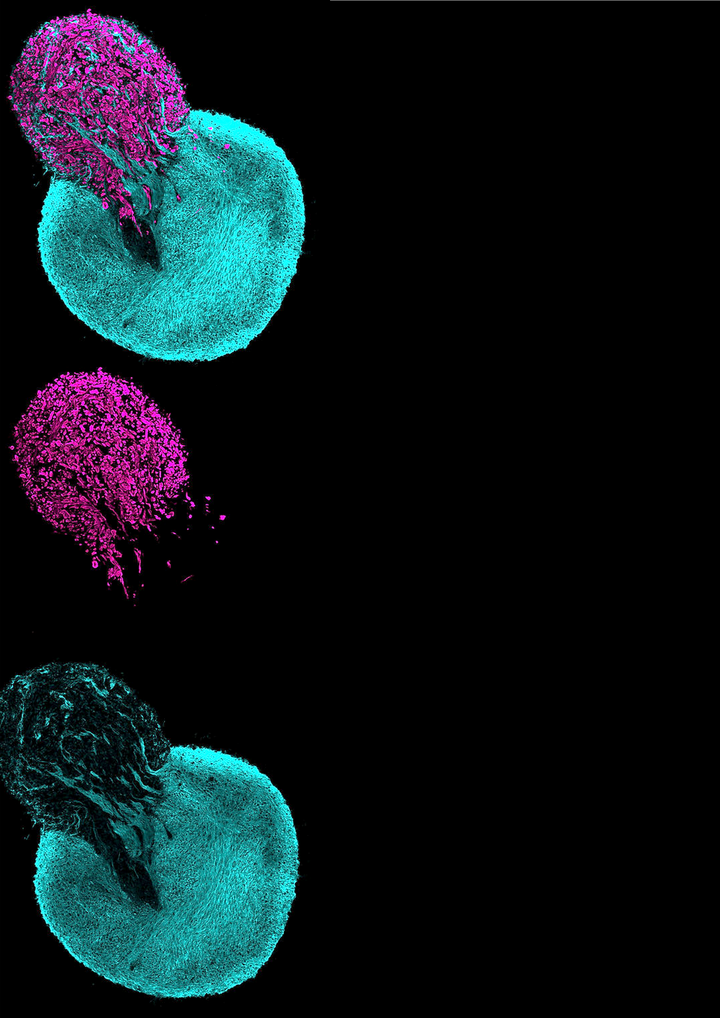 Header Organoid Symposium