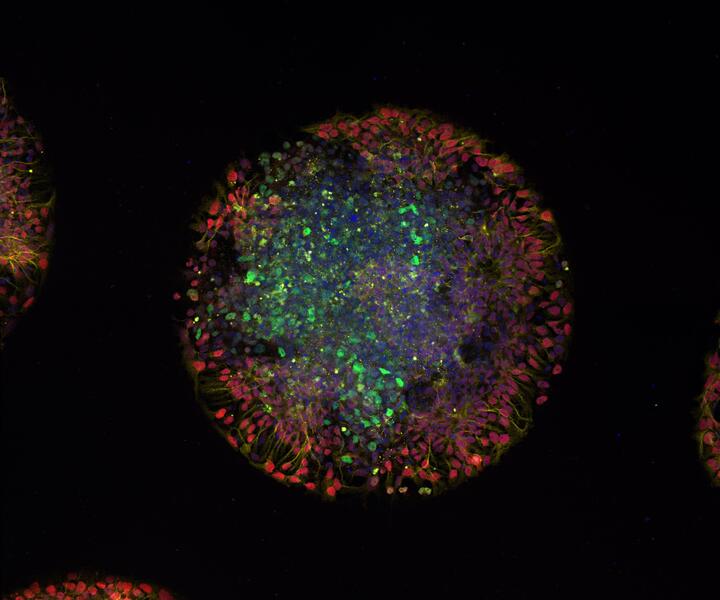 A day-old micropatterned organoid generated from induced pluripotent stem cells (iPSCs) derived from a patient with a mutation in the IRF2BPL gene. The different colors mark distinct cell populations, which reveal how the organoid is organizing into layers of developing neural tissue. It provides a snapshot of early human brain-like development in this patient-derived model.