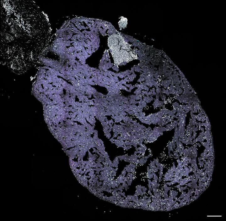 Zebrafish heart after cryoinjury
