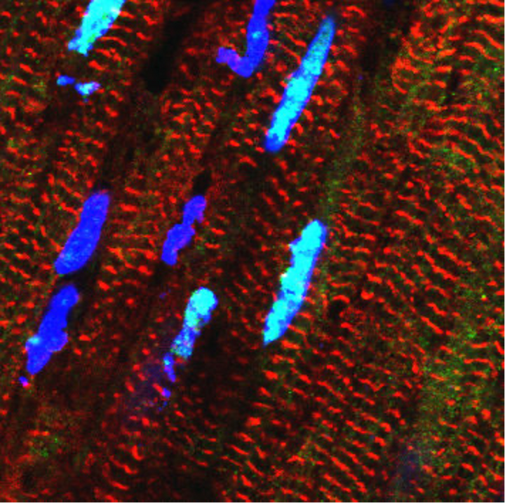 Das Bild zeigt Herzmuskelzellen, in denen das RBM20-Protein hellblau leuchtet.