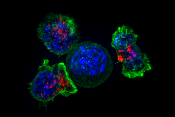 T-Zellen greifen eine Krebszelle an