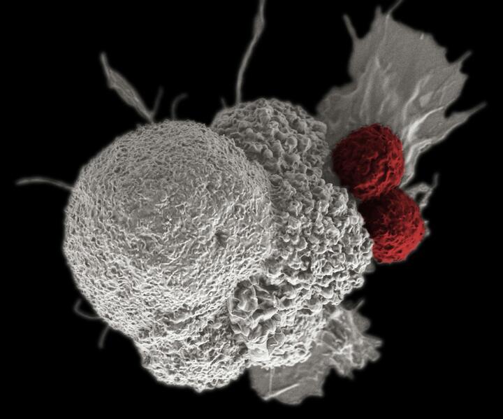 T-cells (highlighted red) attacking a cancer cell