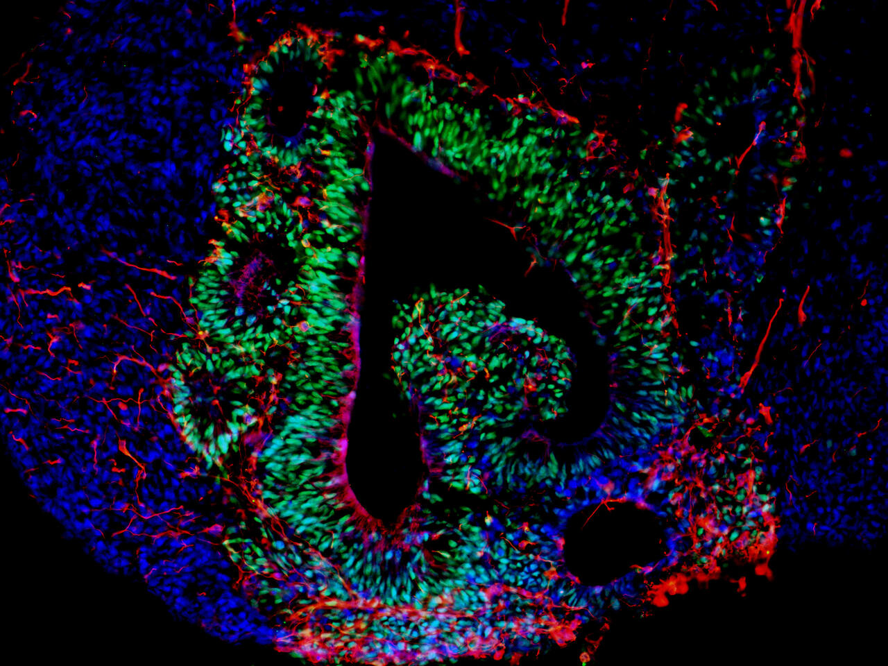 Tracking development cell by cell is ‘Breakthrough of the Year ...