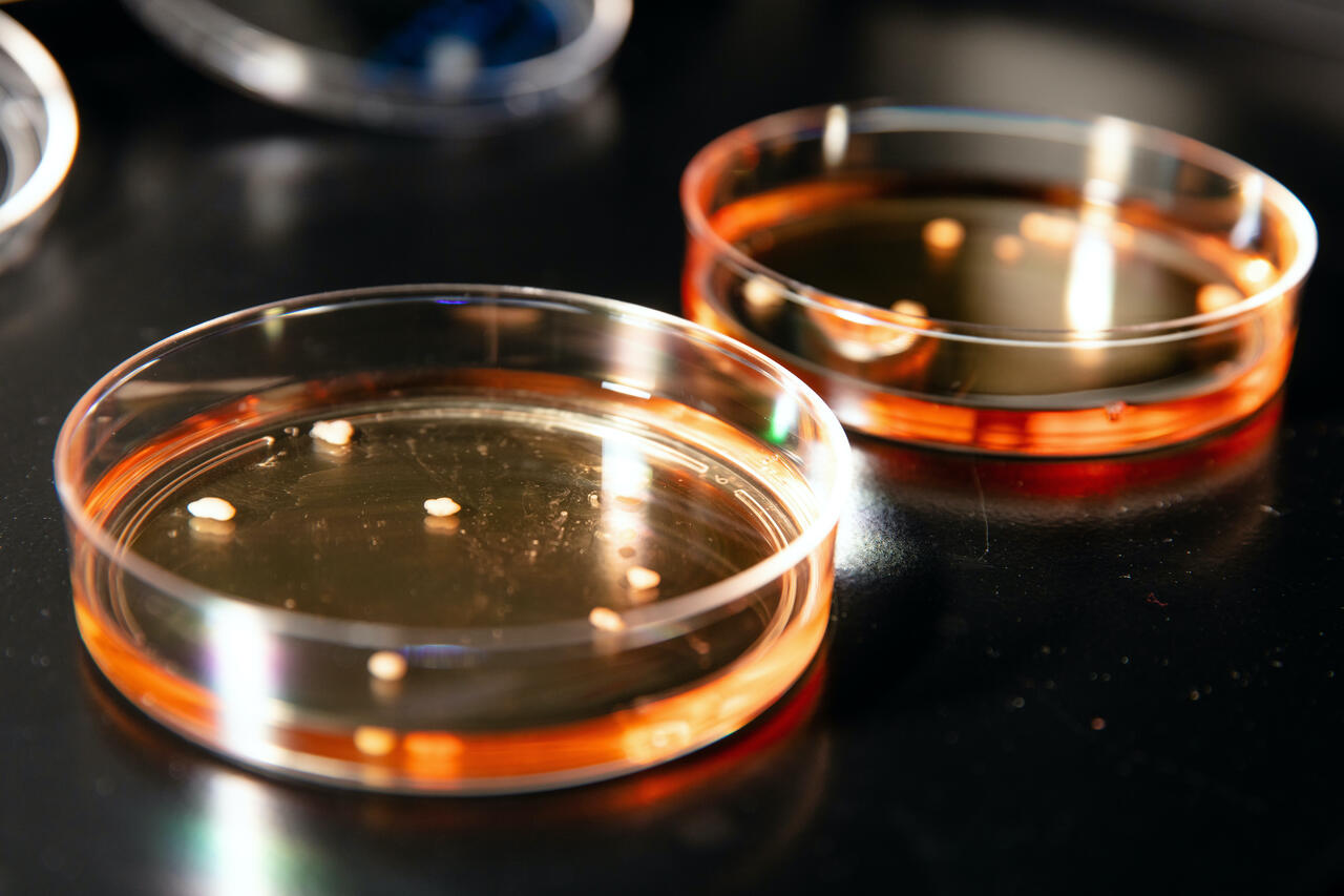 Organoids And Sequencing Team Up For Als Research Mdc Berlin