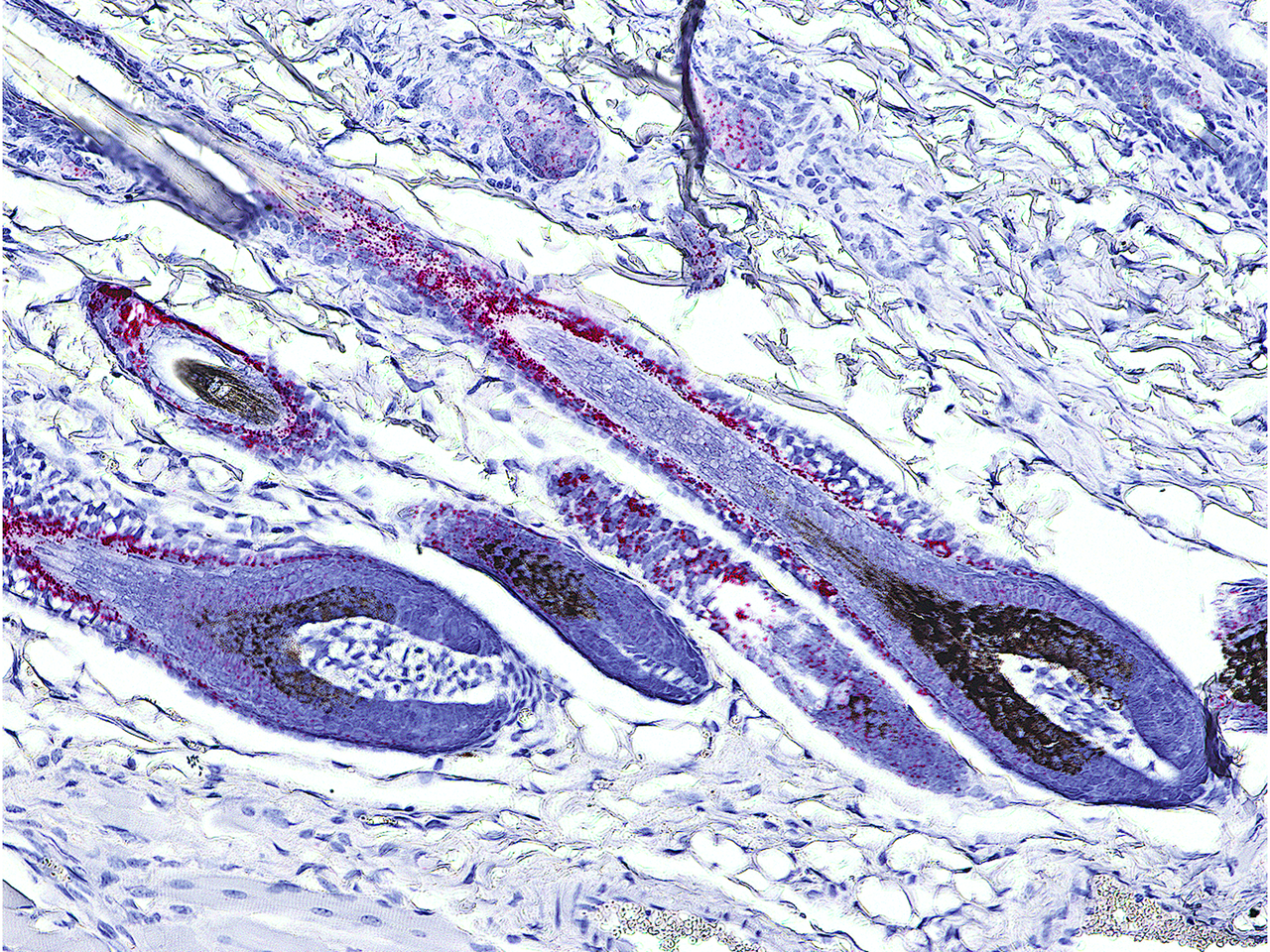 Treating skin diseases with ACE2 inhibitors | Max Delbrück Center